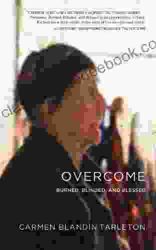 Overcome: Burned Blinded And Blessed